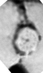 ��������(��������)